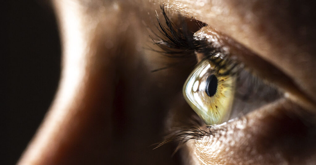 Speciallinser & keratokonus